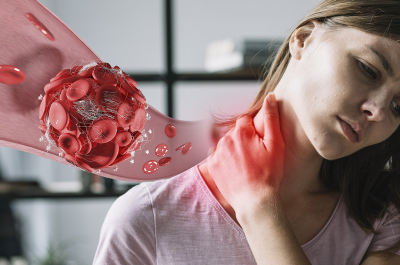 Кожные высыпания под воздействием солнечных лучей при СКВ