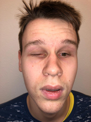 До операции