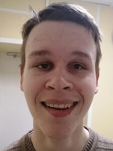 После операции