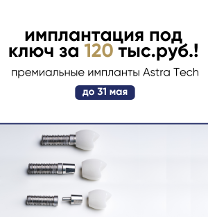 Имплантация зубов