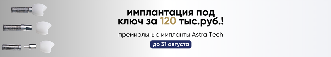 Имплантация зубов